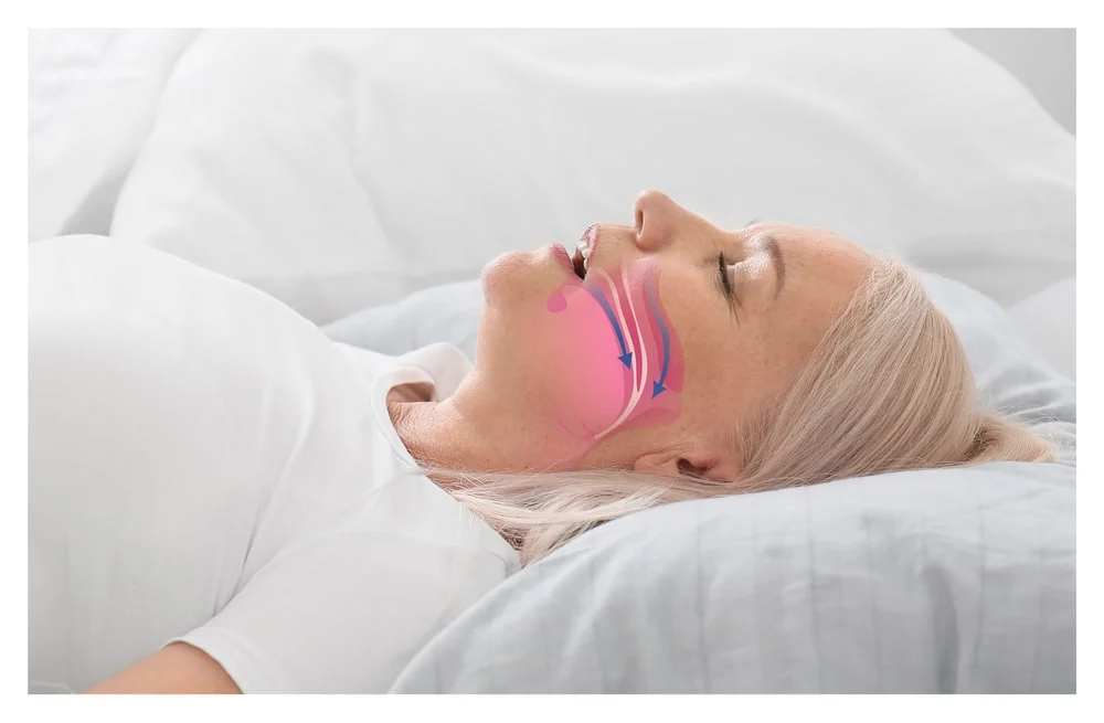 Evaluación de apnea del sueño